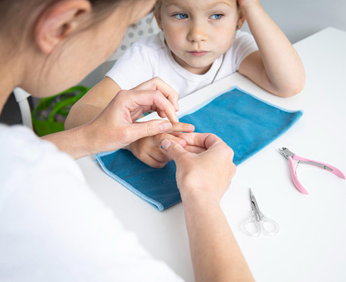 Treatment of Subungual Hematoma in Children