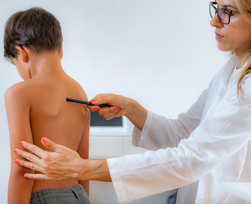 How does a doctor diagnose a back contusion in a child?