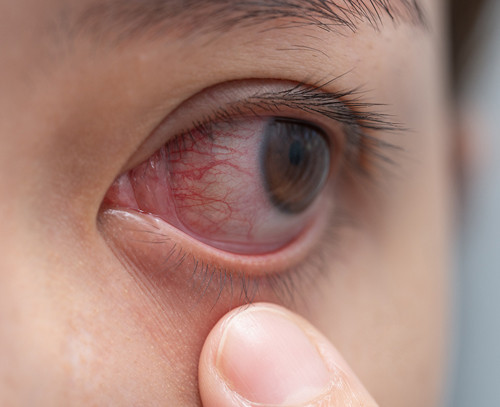 Possible Complications and Consequences of Injury