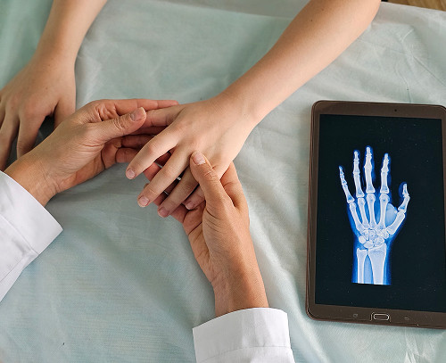 Diagnosing a Little Finger Fracture