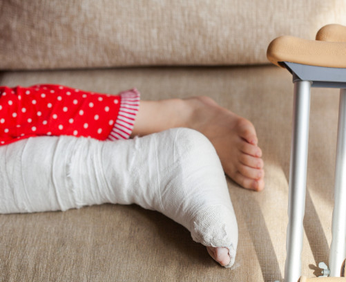 How to Treat a Child's Leg Fracture