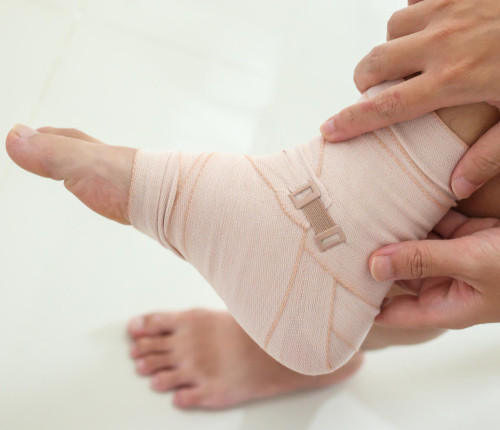 What is an ankle sprain in children?