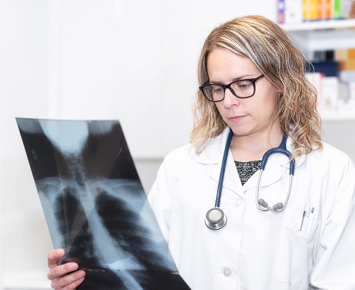 What is a rib fracture in a child?