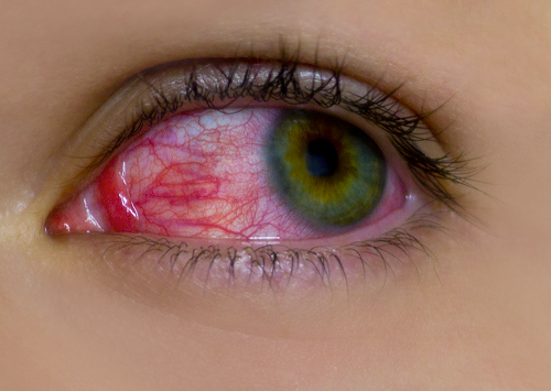 When to See an ophthalmologist urgently