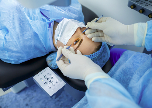 How is a vitreous wartectomy performed?