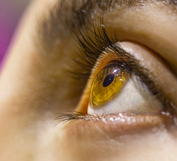 When do we recommend posterior lamellar keratoplasty?