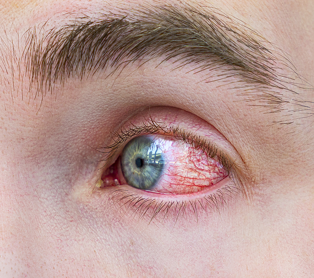 When are intravitreal injections really needed?