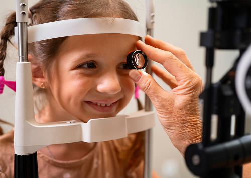 How does the fitting process work?