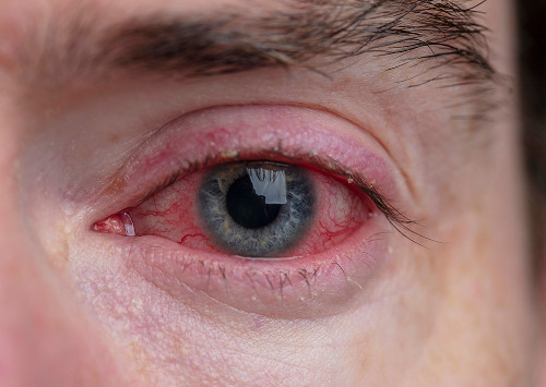 Contraindications, limitations, and possible risks