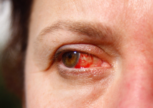 Potential complications with incorrect actions