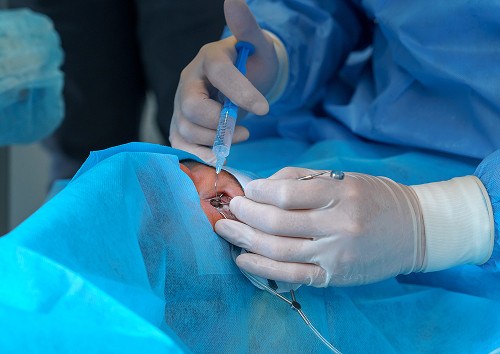 How is eyelid growth removal performed?