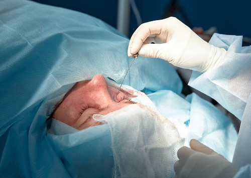 How is pterygium removal performed at our clinic?