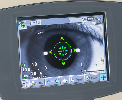 What is ultrasound eye biometry and why is it needed?