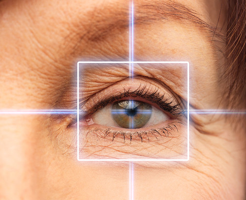 What is focal laser coagulation and why is it needed?