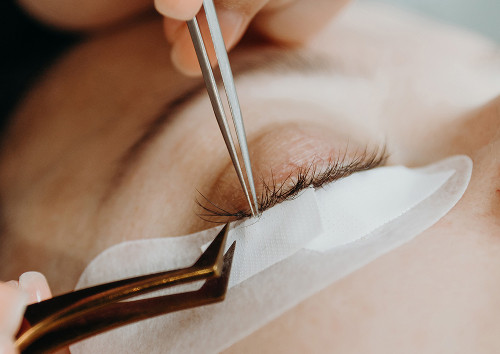 What is eyelash hair removal and when is it needed?