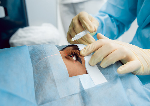 How is glaucoma surgery performed?