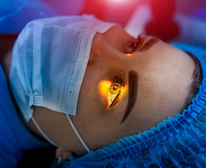 What is barrier laser coagulation and why is it needed?