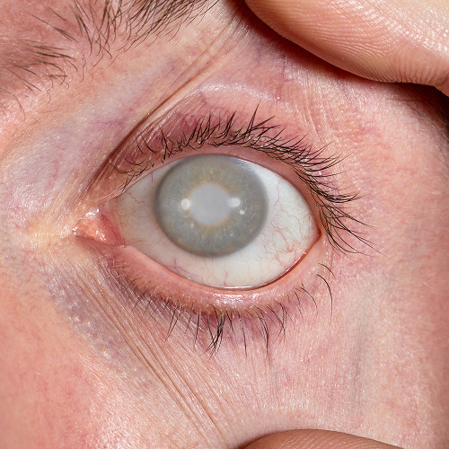 Symptoms you shouldn't ignore