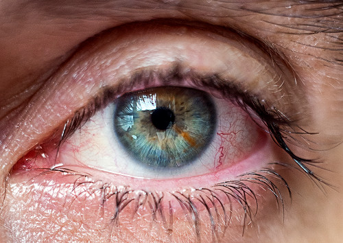 What is chorioretinitis and why is it dangerous?