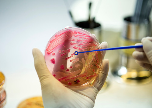 What do genetic test results mean?