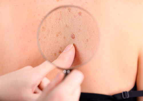 Symptoms of Soft Tissue Tumors