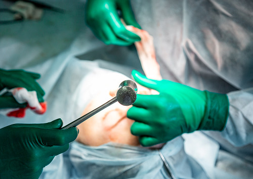 Treatment of Cancer of the Paranasal Sinuses and Nasal Cavity