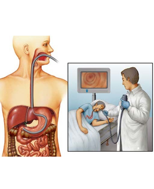 Esophagogastroduodenoscopy