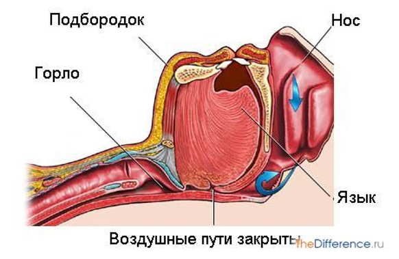 О заболевании