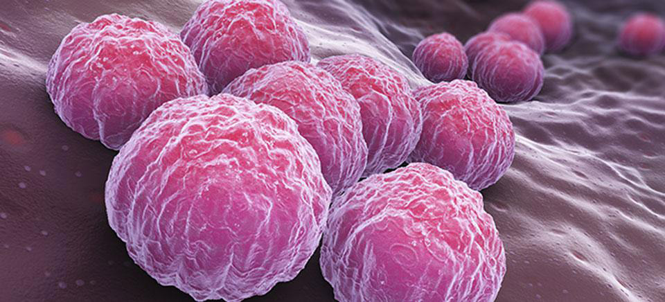 lymphogranulomatosis Trichomonas