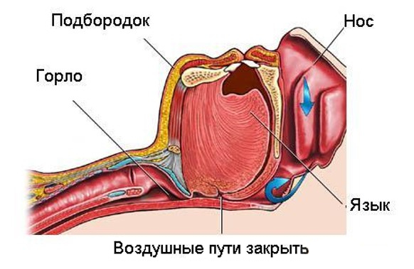 О заболевании