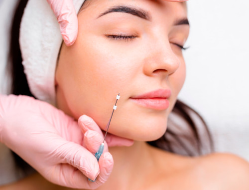 Non-surgical lifting with mesothreads in the clinic 