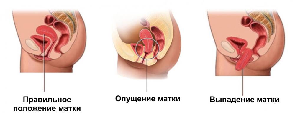 Фото Как Выглядят Женские Половые