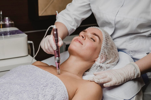 Benefits of RF lifting for rejuvenation