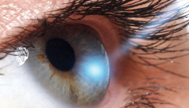 Laser vision treatment and correction