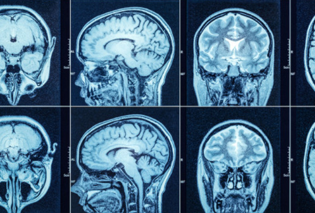 Cognitive evoked potentials