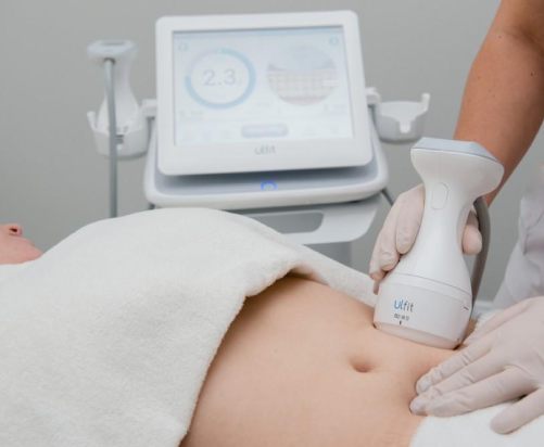 What is ultrasonic liposuction?