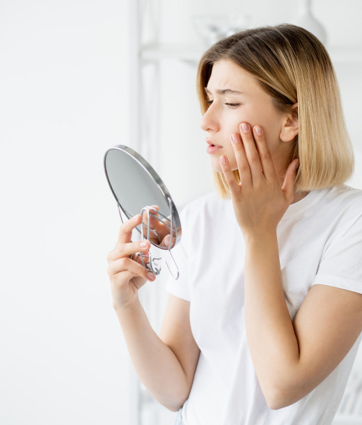Acne on the face, girl
