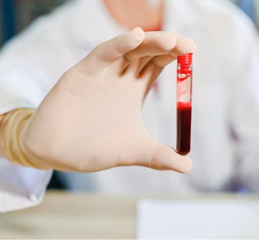 Physiological and pathological leukocytosis