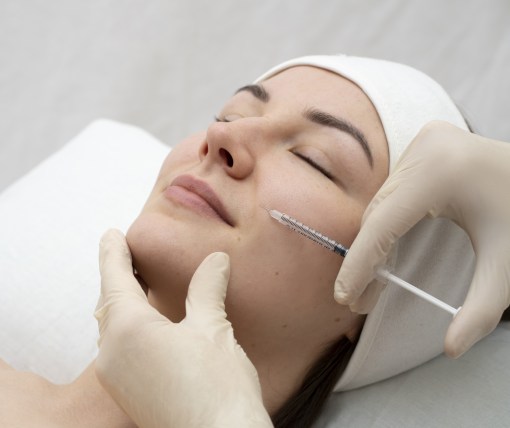 Features of Dermahil mesotherapy