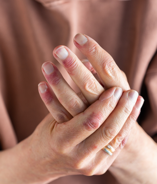 About the disease - dermatitis on the skin