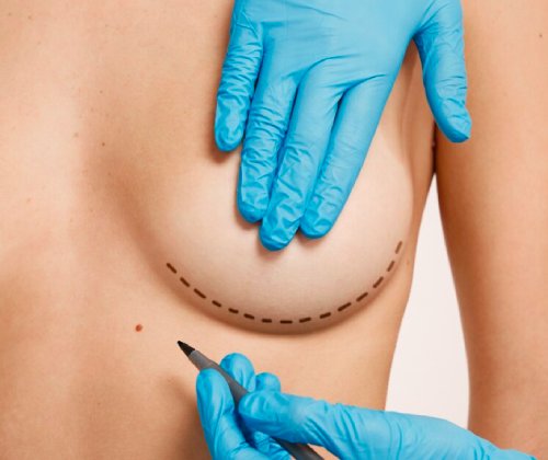 Показания к хирургии молочных желез