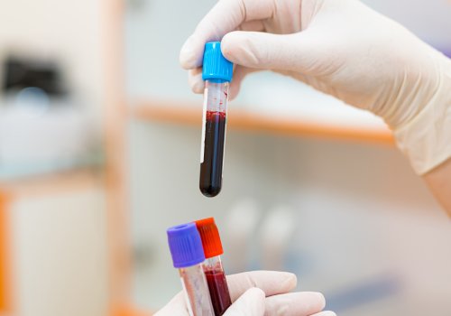 The role of lymphocytes in the body