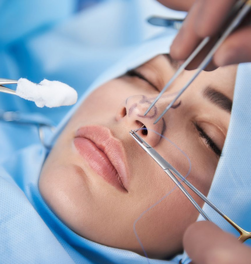 Why do septoplasty?