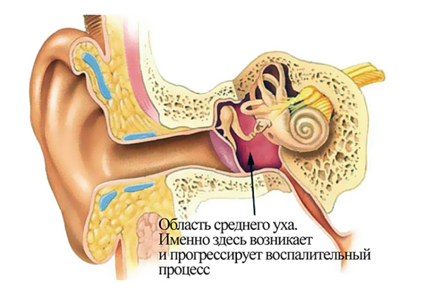 О заболевании